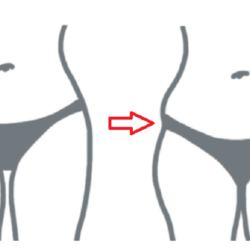 how to get rid of hip dips