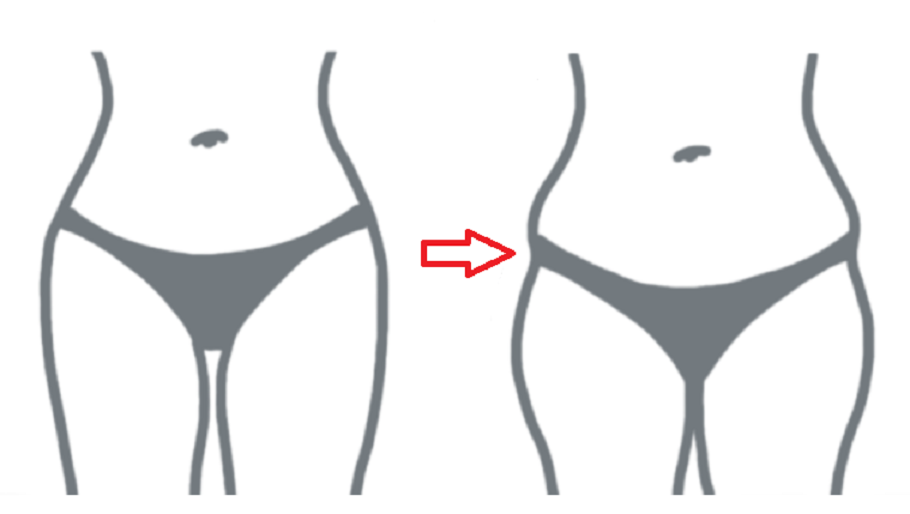 how to get rid of hip dips